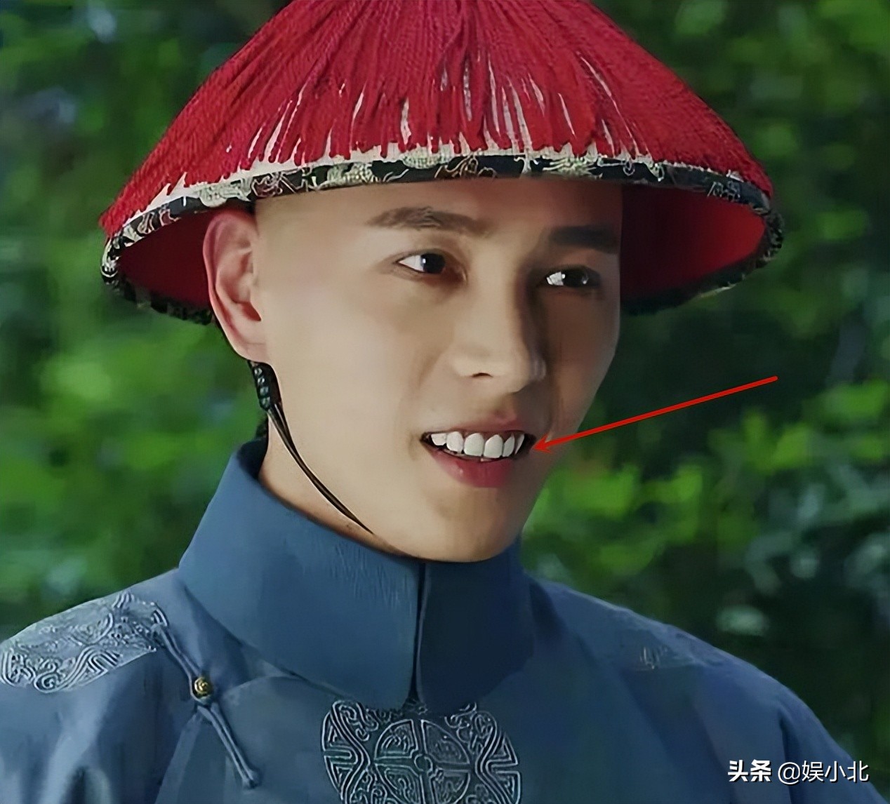 说刘亦菲牙齿丑的，是烤瓷牙看多了吧？