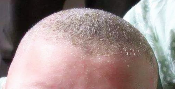 时间越久自然会滋生不少的细菌,影响宝宝的健康