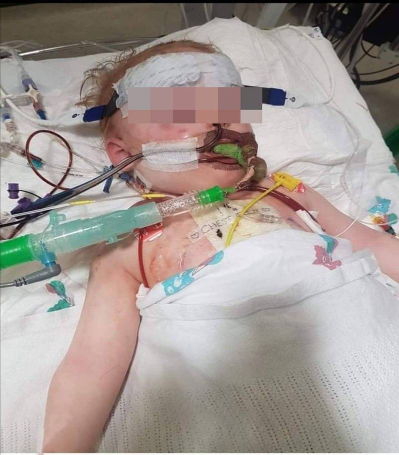 英国2岁男婴误吞纽扣电池，心脏被烧伤去世！小电池为何这么毒？