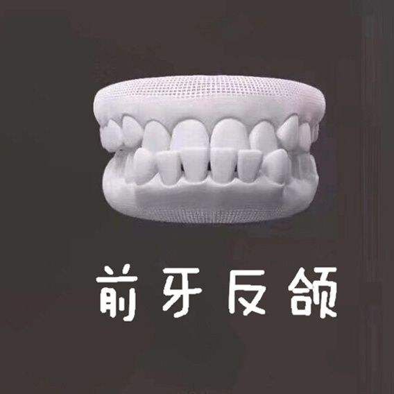 “地包天”是什么原因导致的？哪些是我们可以做到，可以预防的？