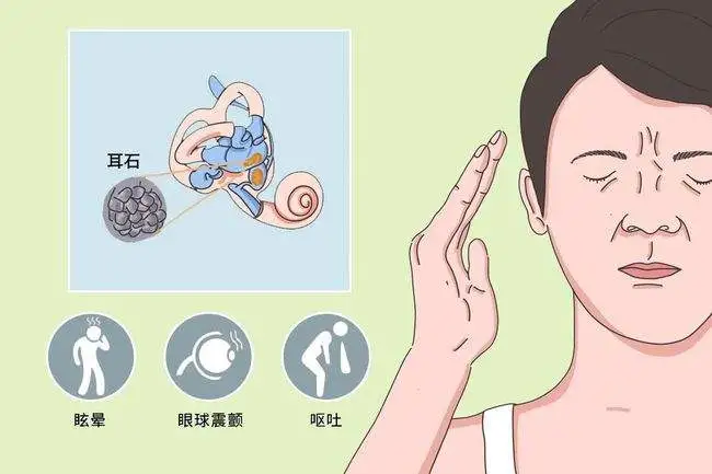 晕从耳中来：小心耳朵里“疯狂的石头”，医生来剖析耳石症