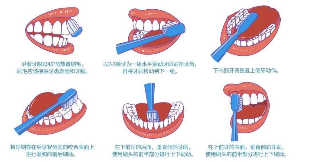 牙齿长什么样是标准的(牙齿达到5个标准，说明你很健康)