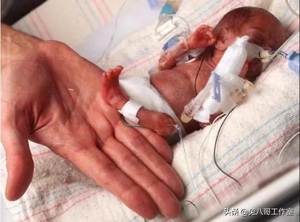 16年前,美国真实版拇指姑娘出生时只有25厘米. 后来发生了什么