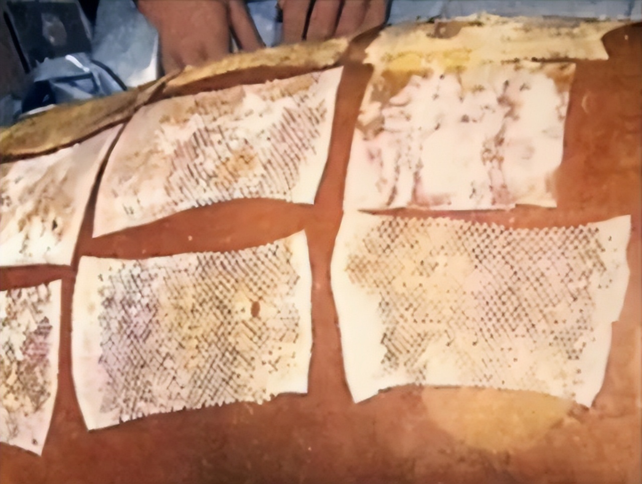 在遭受2万倍辐射之后,他亲眼看着自己的身体腐烂却无能为力