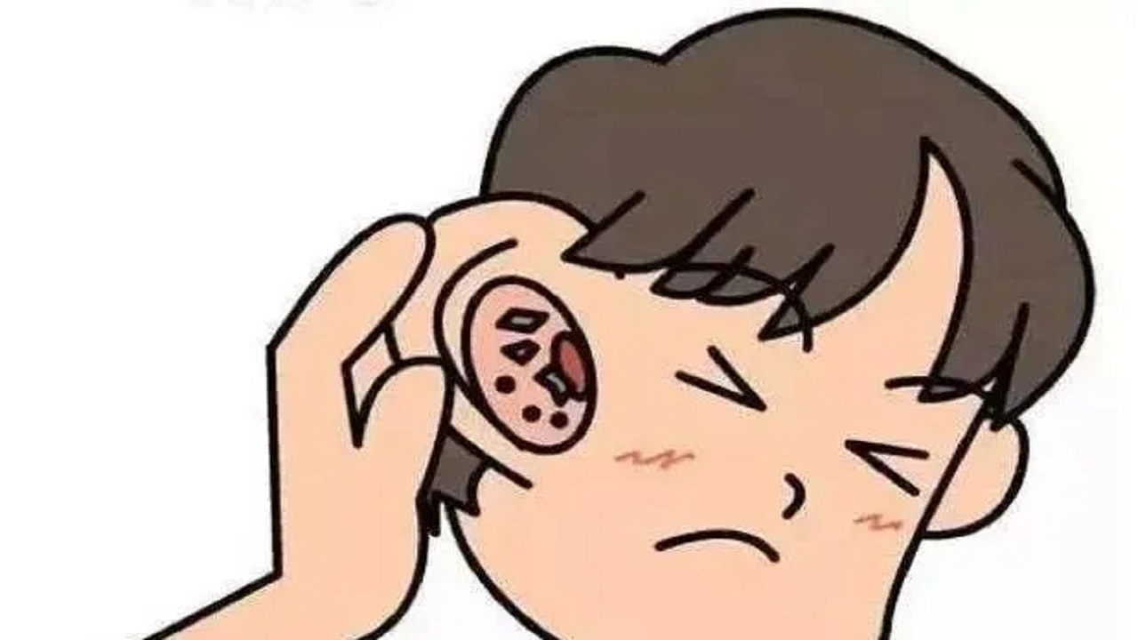 耳朵里面痒，却啥也掏不出来？或是4种病的表现，别光顾着抠了
