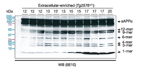 阿尔茨海默症开创性论文涉嫌造假，后果究竟有多严重？