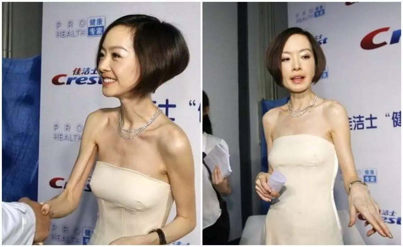 中国女星身材争议：盘点被过度关注的女性艺人