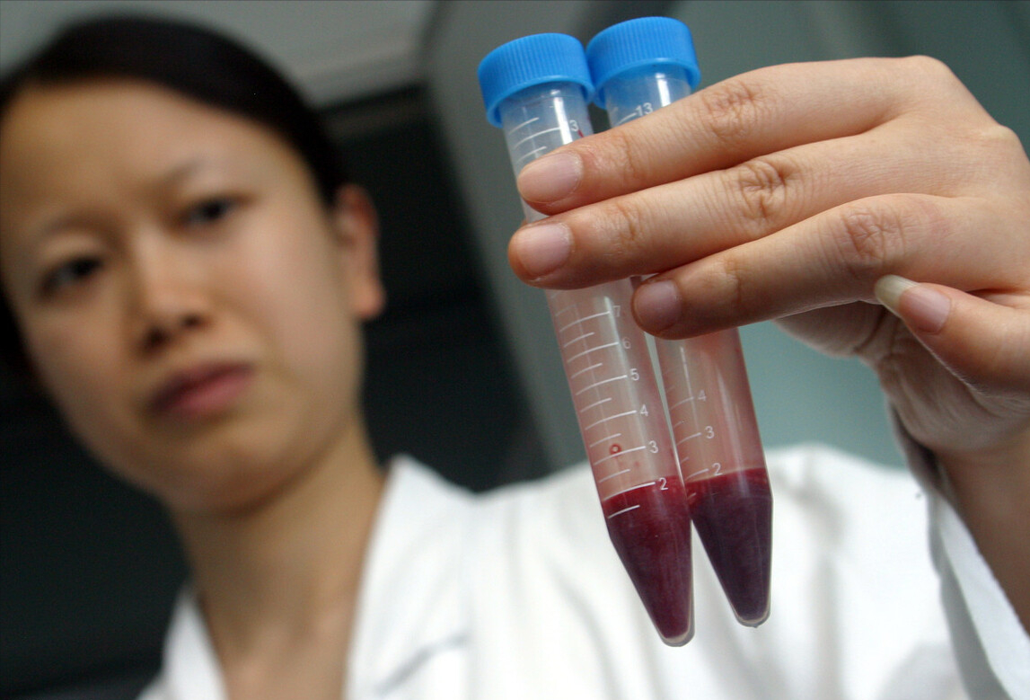 产前亲子鉴定，为何被称为“忠贞杀手”？