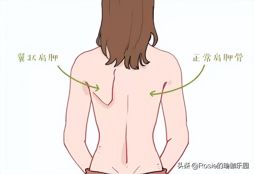 赵丽颖官宣美出新高度，体重不过百还是胖？四个体态问题要关注