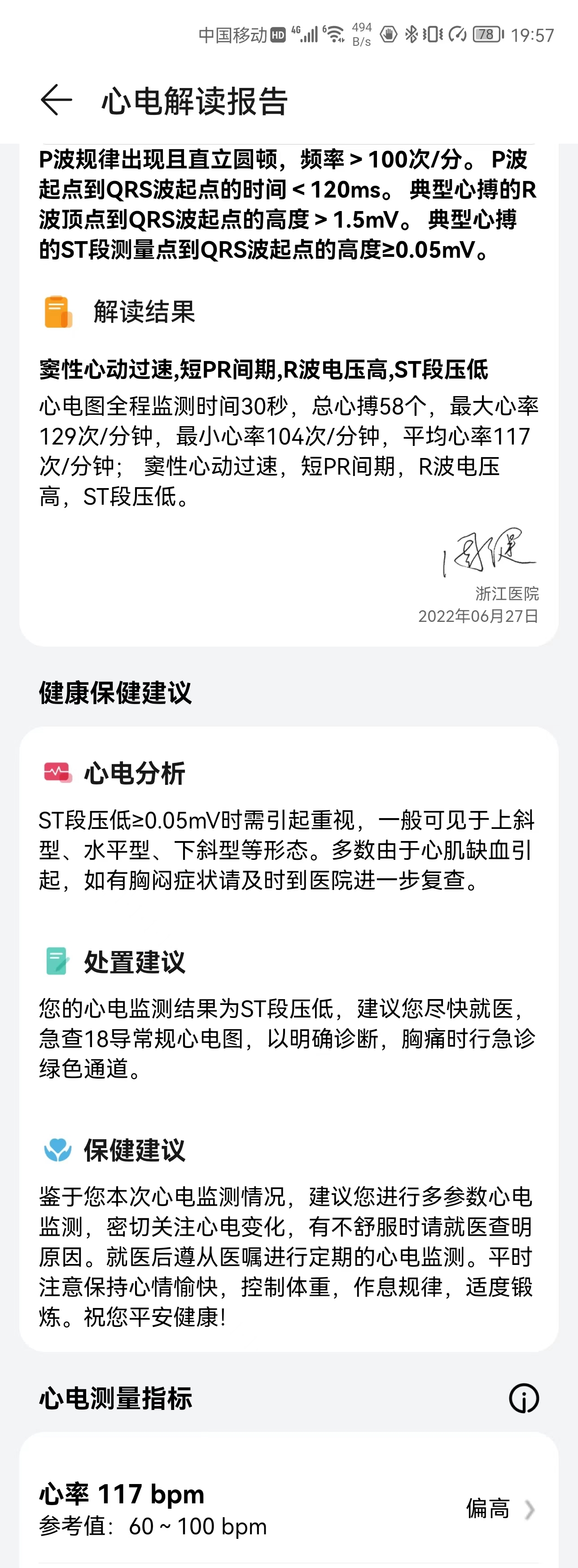华为GT3Pro我还是比较满意的