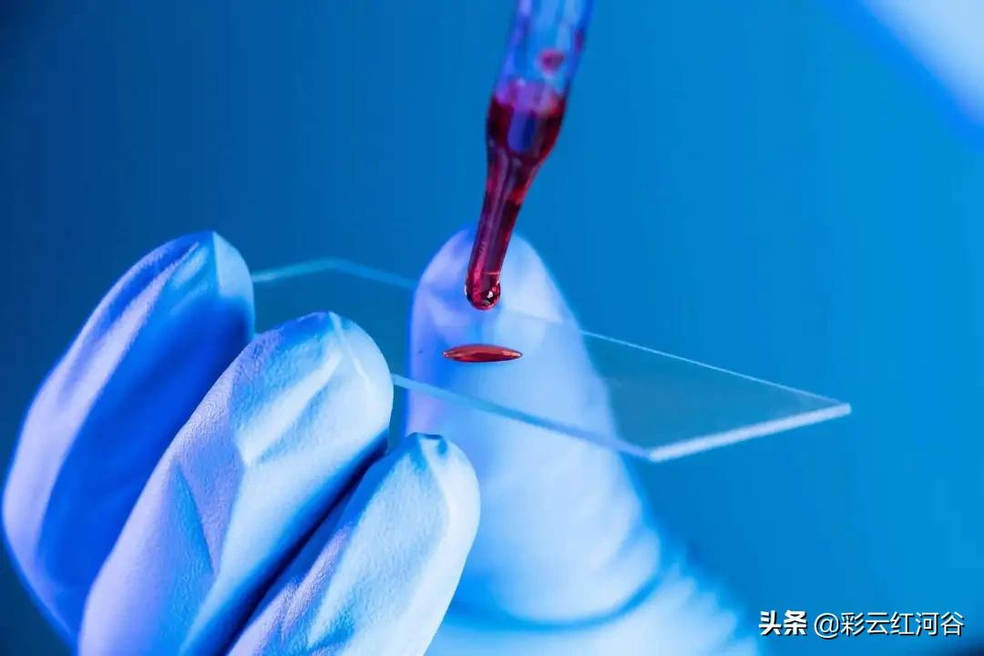 你知道吗,艾滋病也可以测核酸