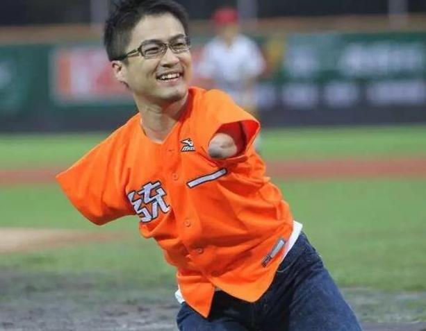 又或者手和脚直接粘连在身体上,就像是海豹一样,所以又叫做海豹肢症