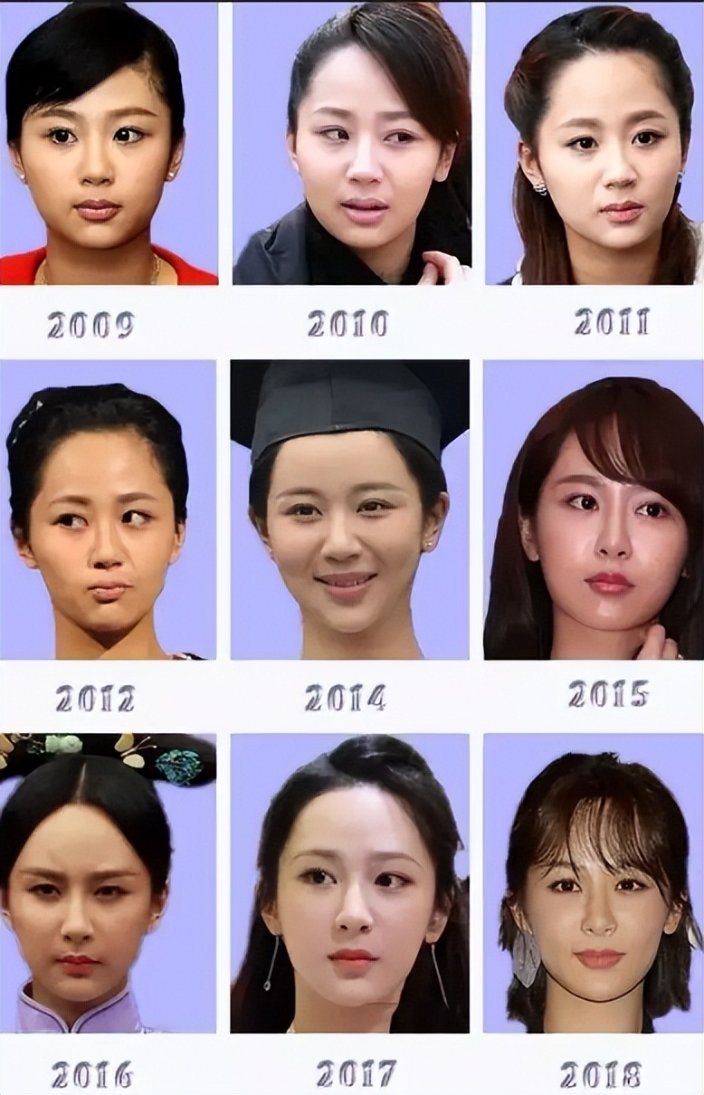 颜值忽高忽低、脸部时好时坏，这些灵动的女明星，都被医美坑惨了