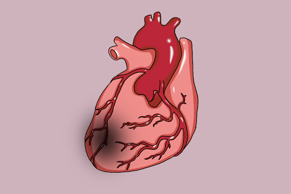 心梗来临，喉咙知道？心脏出现7个异常表现，提醒你该检查了