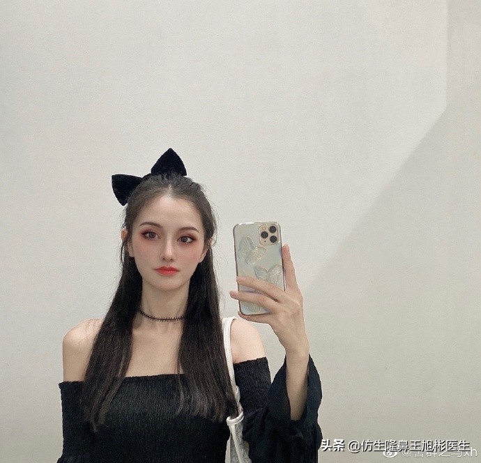 广州隆鼻科普：王旭彬鼻整形修复案例分享
