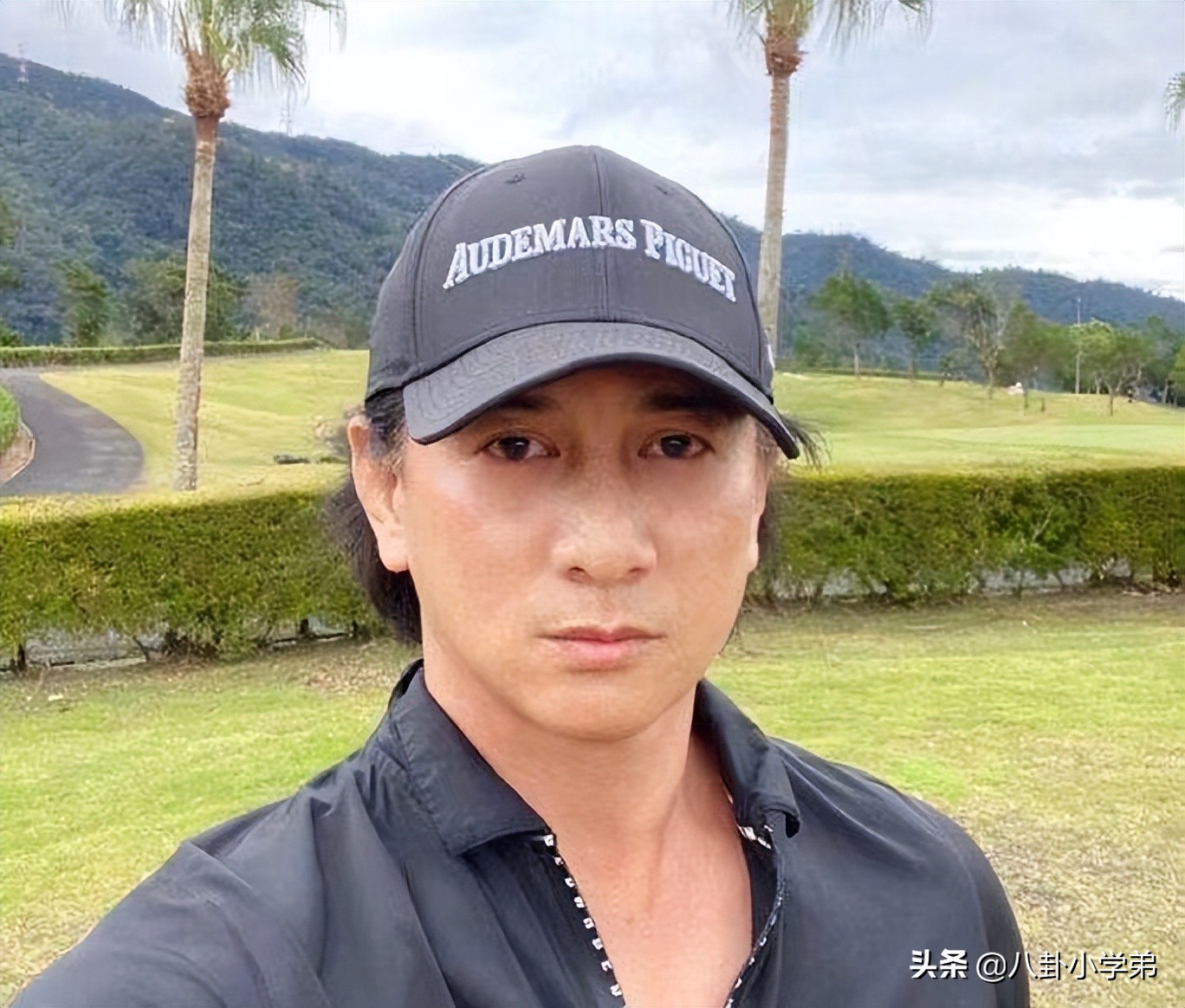 “冻龄男神”都是假的！脸肿僵硬、笑不出来，不服老是真的不行