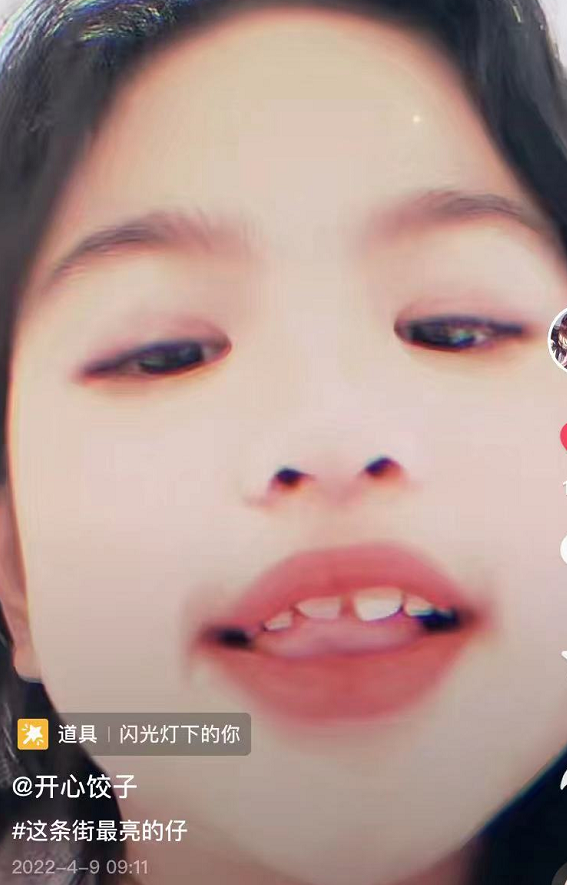 包贝尔女儿晒日常，7岁饺子眨眼放闪气质显成熟，被喊话整牙齿
