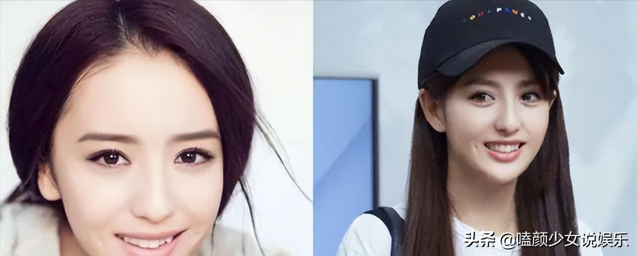 6位兔牙男星代表：有人给气质带来反差萌，有人为牙买天价保险