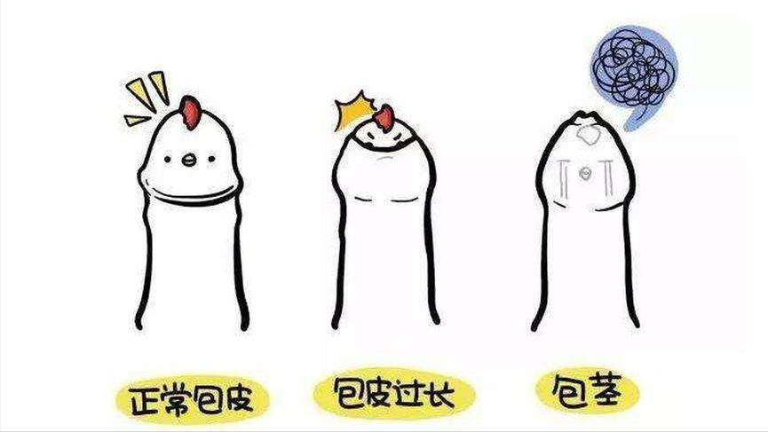 男孩99%包皮过长,到底要不要"割"?小儿泌尿医生这样说