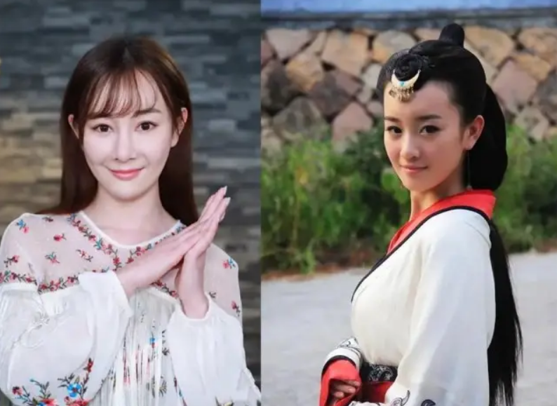 颜值忽高忽低、脸部时好时坏，这些灵动的女明星，都被医美坑惨了