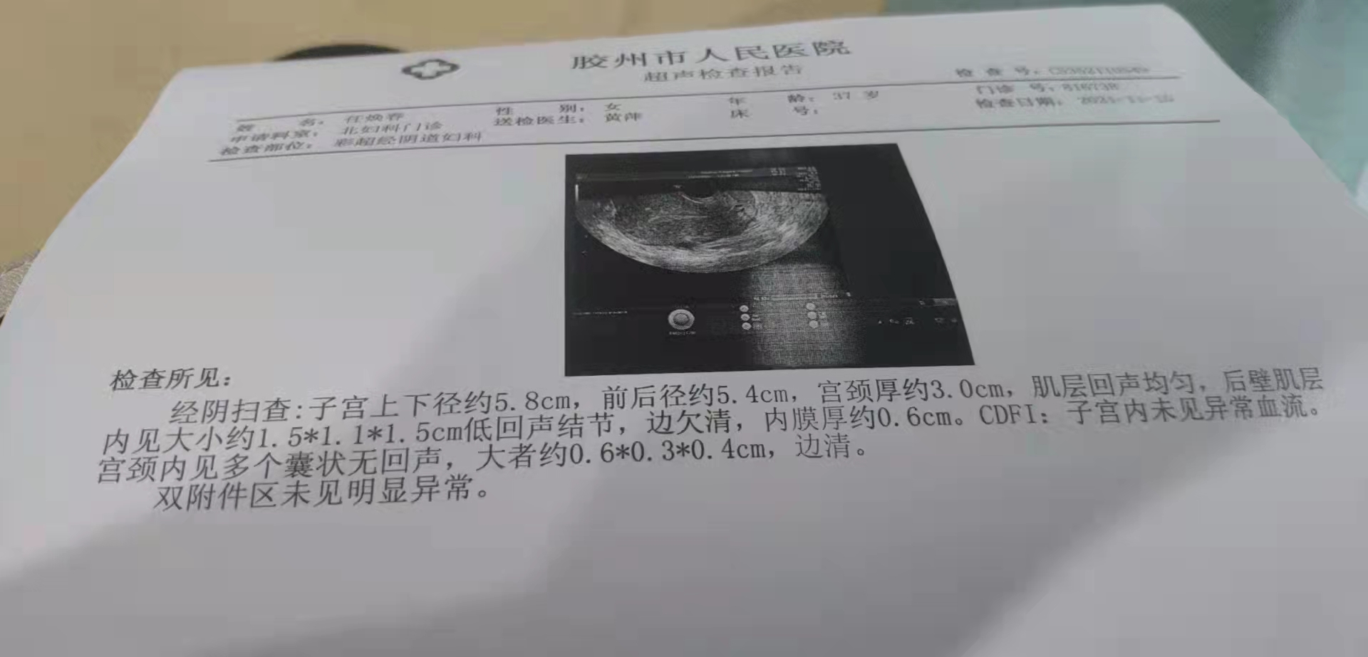 子宫肌瘤2公分不用管？切除子宫谁承担！肌瘤别不当回事