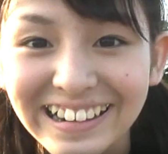 “一张嘴就露馅”的7位童星，缺点被放大，一个比一个亏