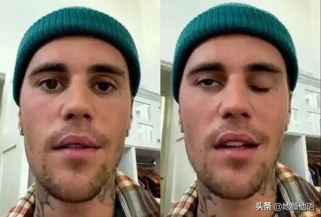 在贾斯汀·比伯因半脸瘫痪而呼救时，塞莱娜·戈麦斯的举动掀起波澜