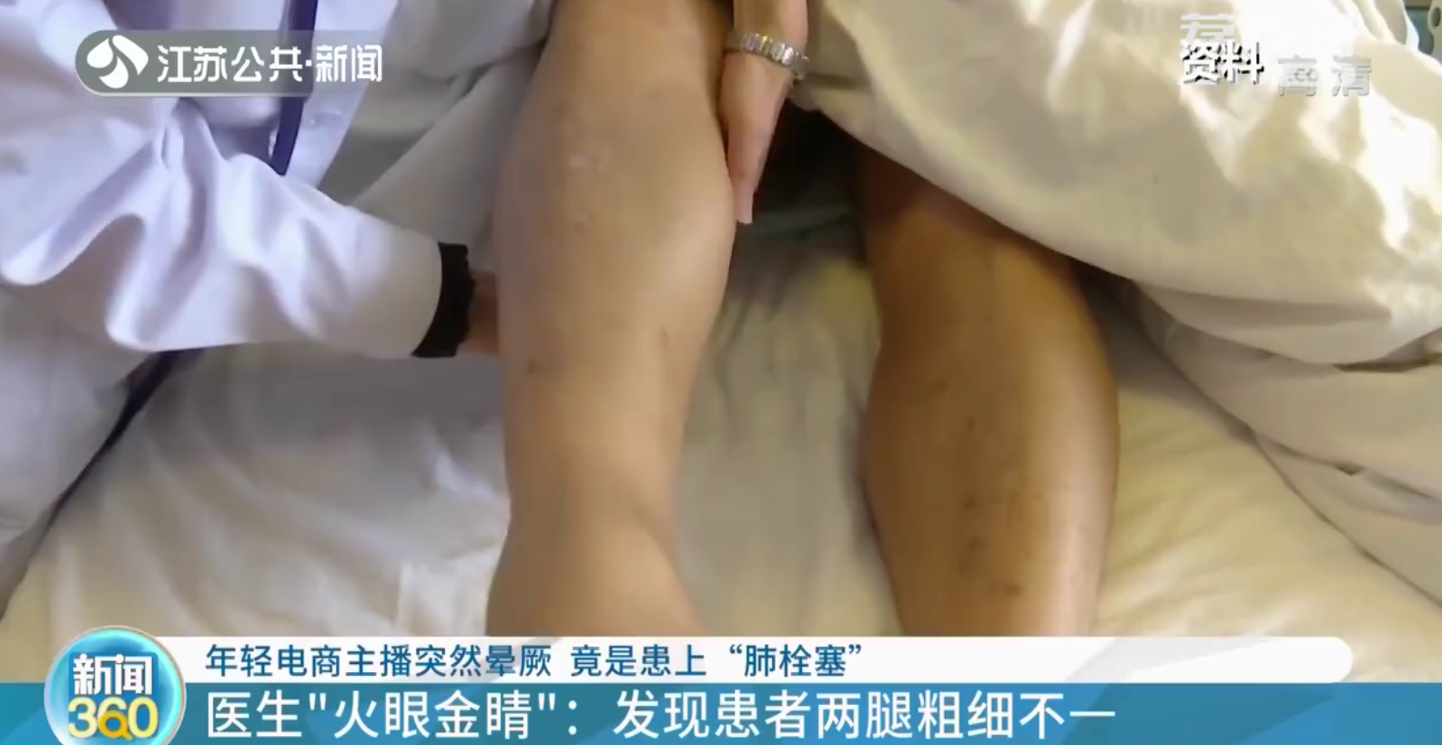 南京：年轻电商主播患&ldquo;肺栓塞&rdquo;昏厥 和久坐有关