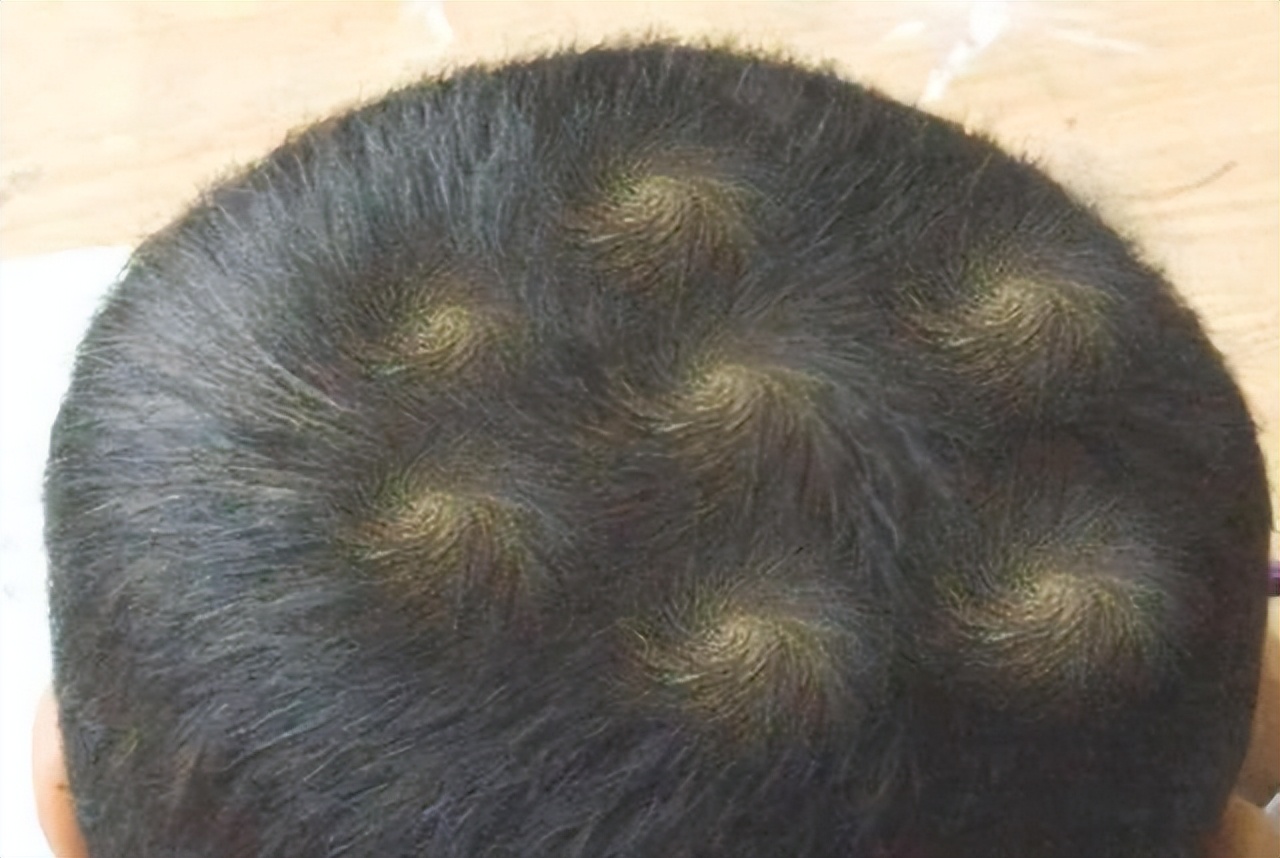 医生告诉你答案