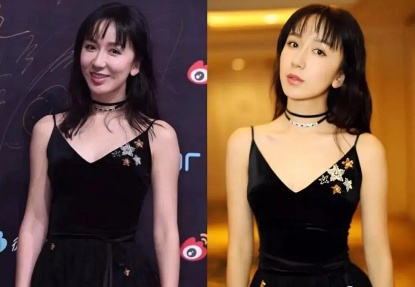 颜值忽高忽低、脸部时好时坏，这些灵动的女明星，都被医美坑惨了