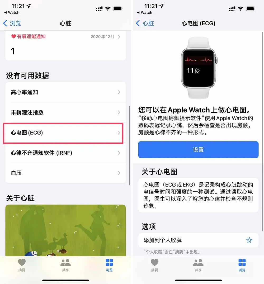 等了 3 年,国行版 Apple Watch 心电图功能终于来了