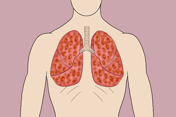 炒出来的致癌物：很多家庭厨房里都有，比吸烟的危害还大