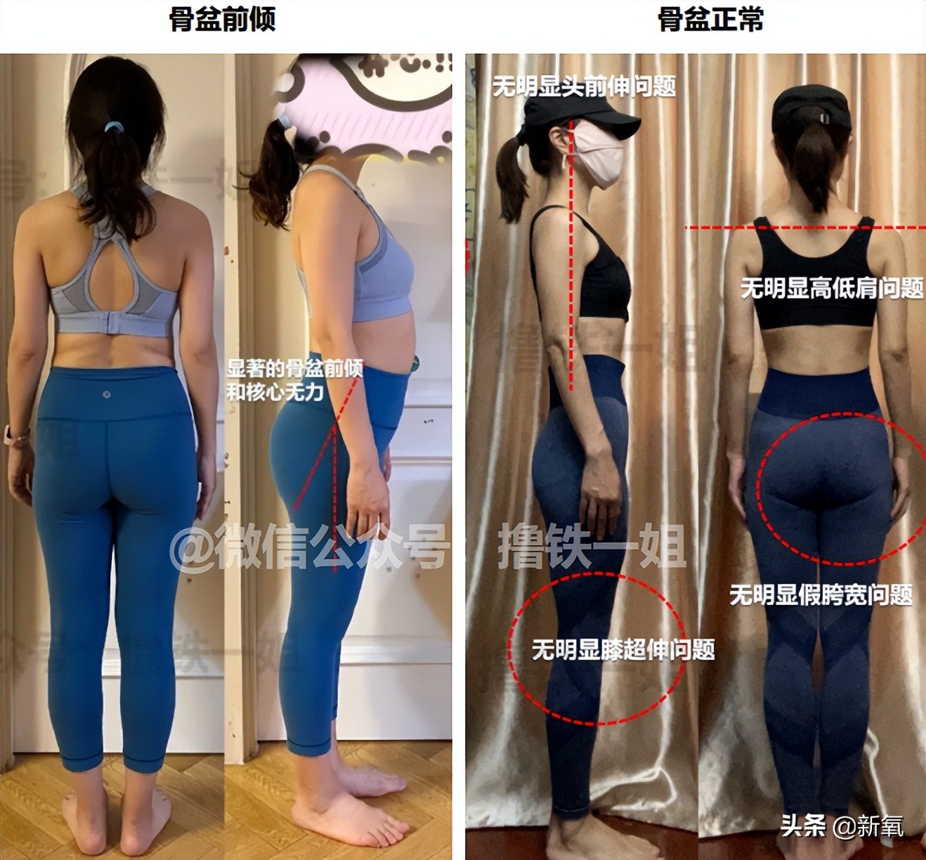 新剧一出场小腹凸成一坨？这翻车的体态硬是被腿精天花板当场救回