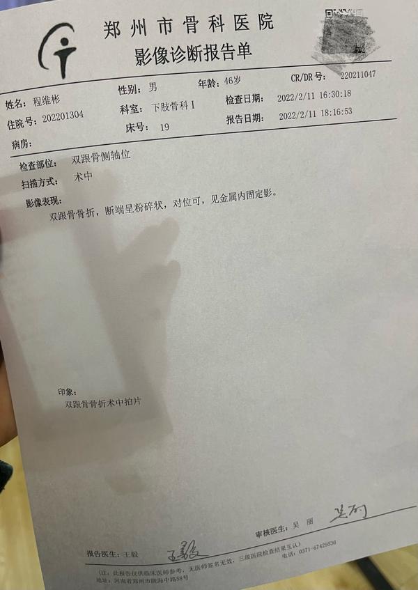 河南大叔跳下3米平臺(tái)救墜樓老人，雙腳粉碎性骨折釘入13根鋼釘