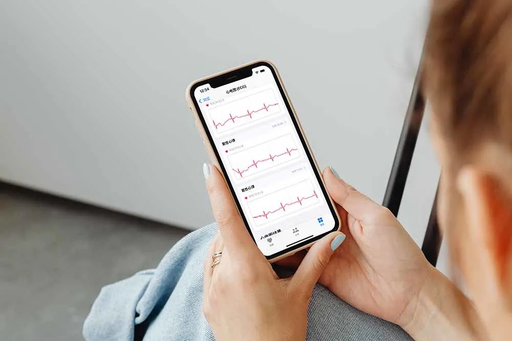 等了 3 年，国行版 Apple Watch 心电图功能终于来了