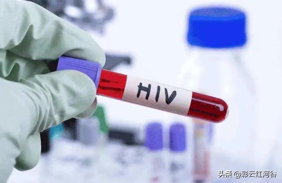 你知道吗,艾滋病也可以测核酸