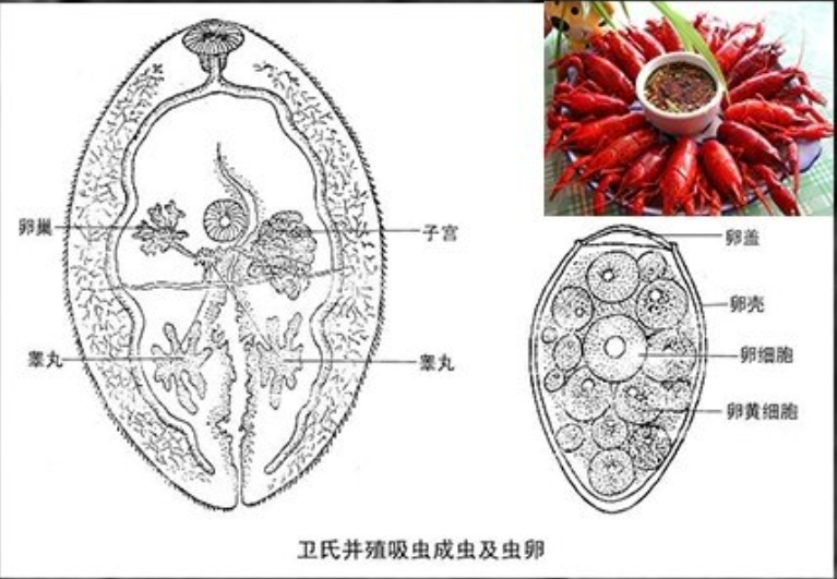 4,生蝦蟹-肺吸蟲