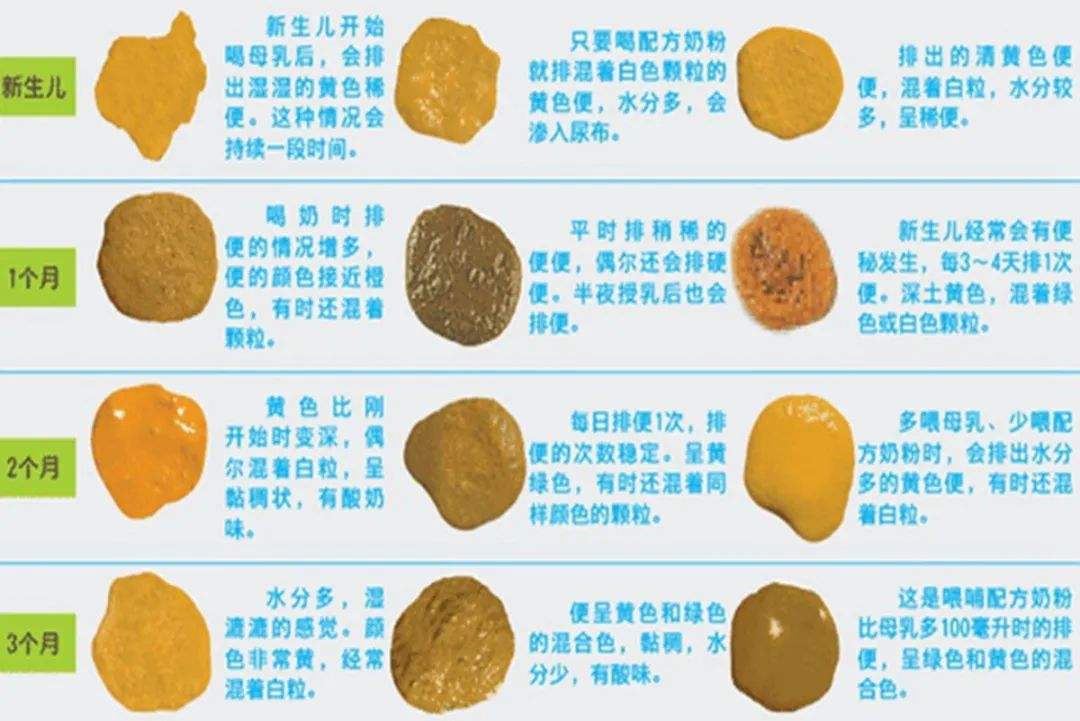 一张大便图教你识别宝宝便便,"六正常六异常"妈妈要清楚