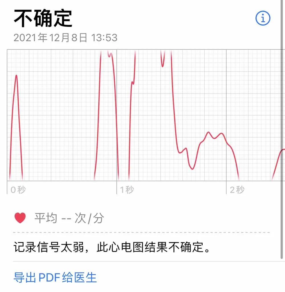 等了 3 年,国行版 Apple Watch 心电图功能终于来了