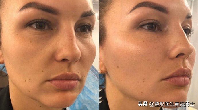 脸部皮肤松弛有什么办法紧致这4种提升方式还不错