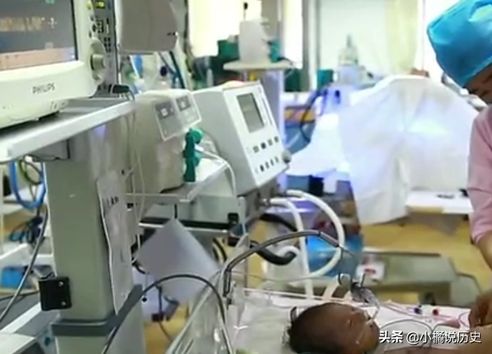 真实故事：北京出生15天婴儿心脏长在肚皮上，随时破裂，母亲崩溃
