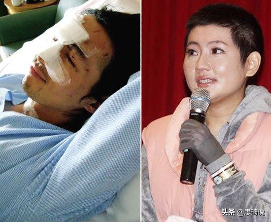 俞灏明的脸、谢霆锋的手、成龙全身是伤，辉煌背后是血泪