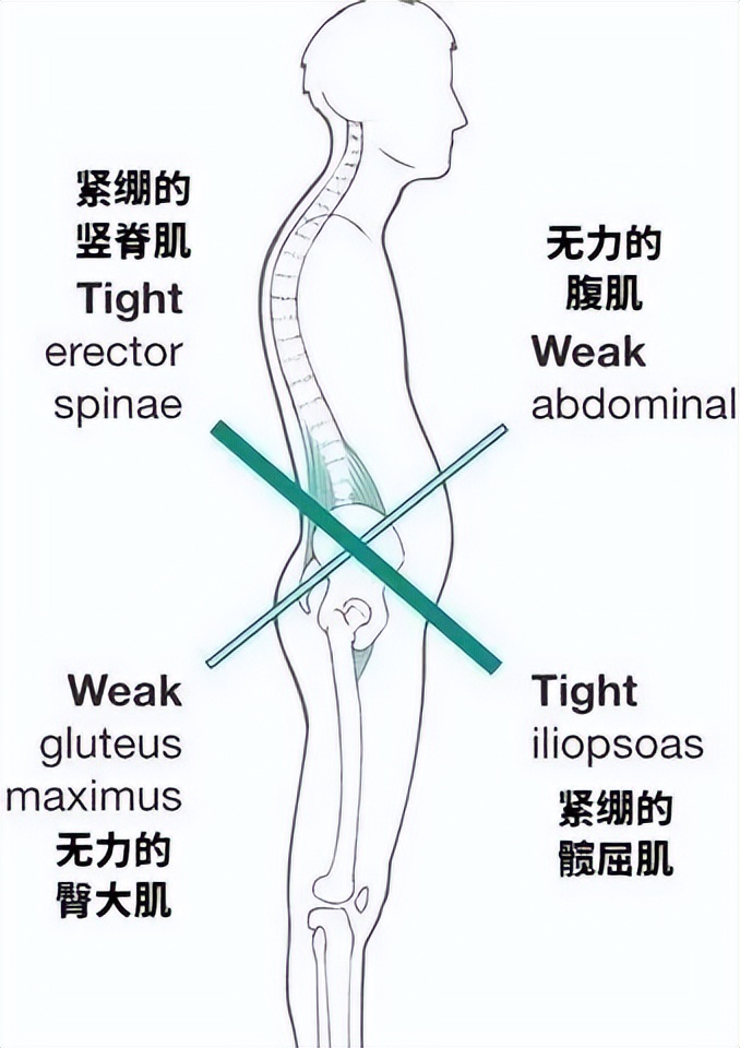 久坐不动，大腿后侧紧？别只做拉伸了，这可能会伤到自己