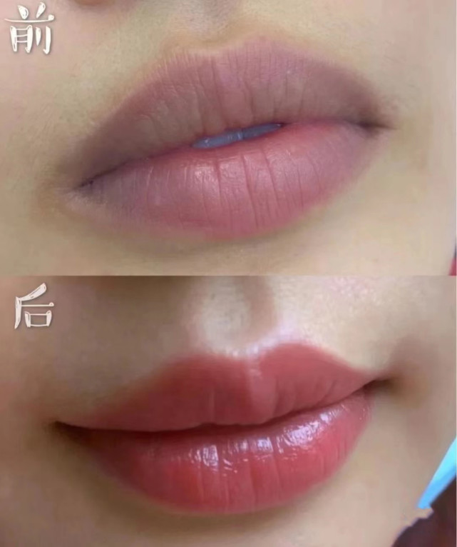 刚恢复好有些不均匀没关系,两个月左右会晕开第二:颜色不均匀这种情况