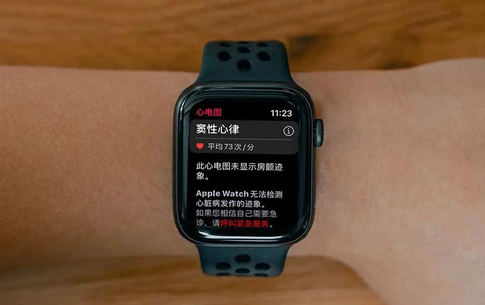 等了 3 年，国行版 Apple Watch 心电图功能终于来了