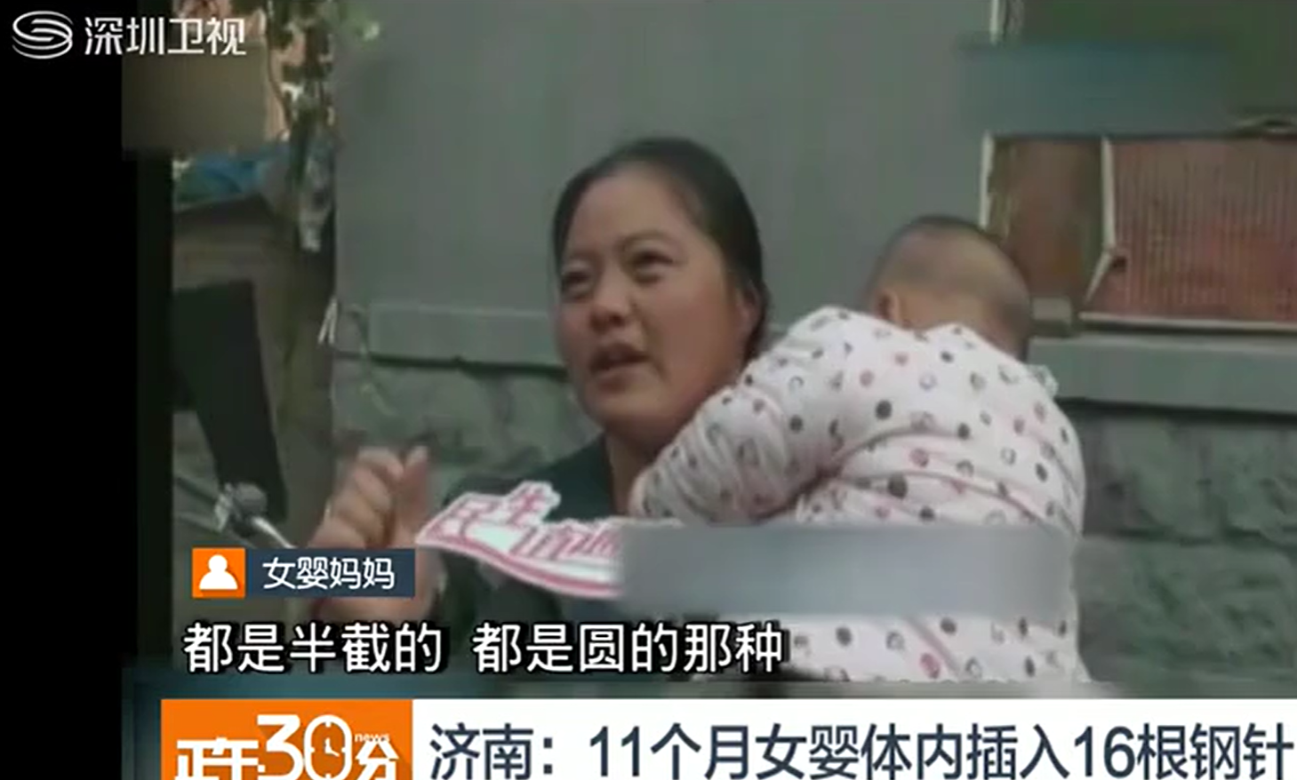 2014年，山东女婴体内“长”16根钢针，得知报警后舅妈服药自杀