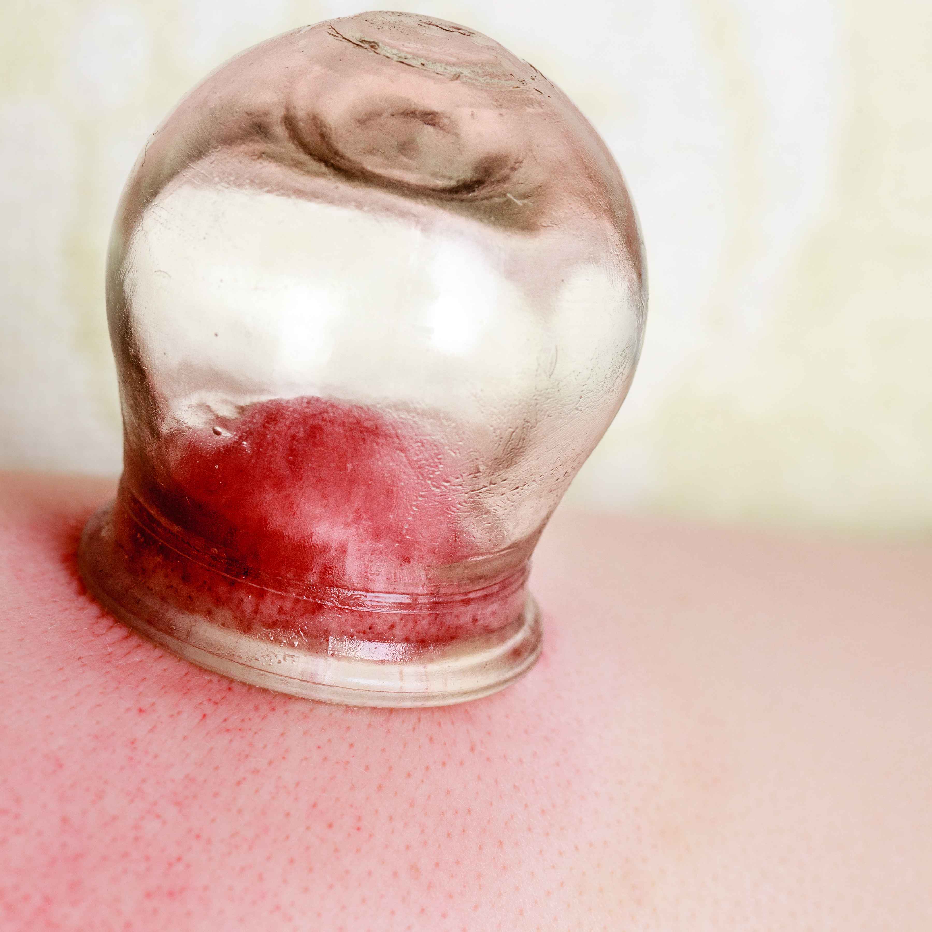 体内湿气重，身体会发出3个信号，若你有，做好这4点或能祛湿