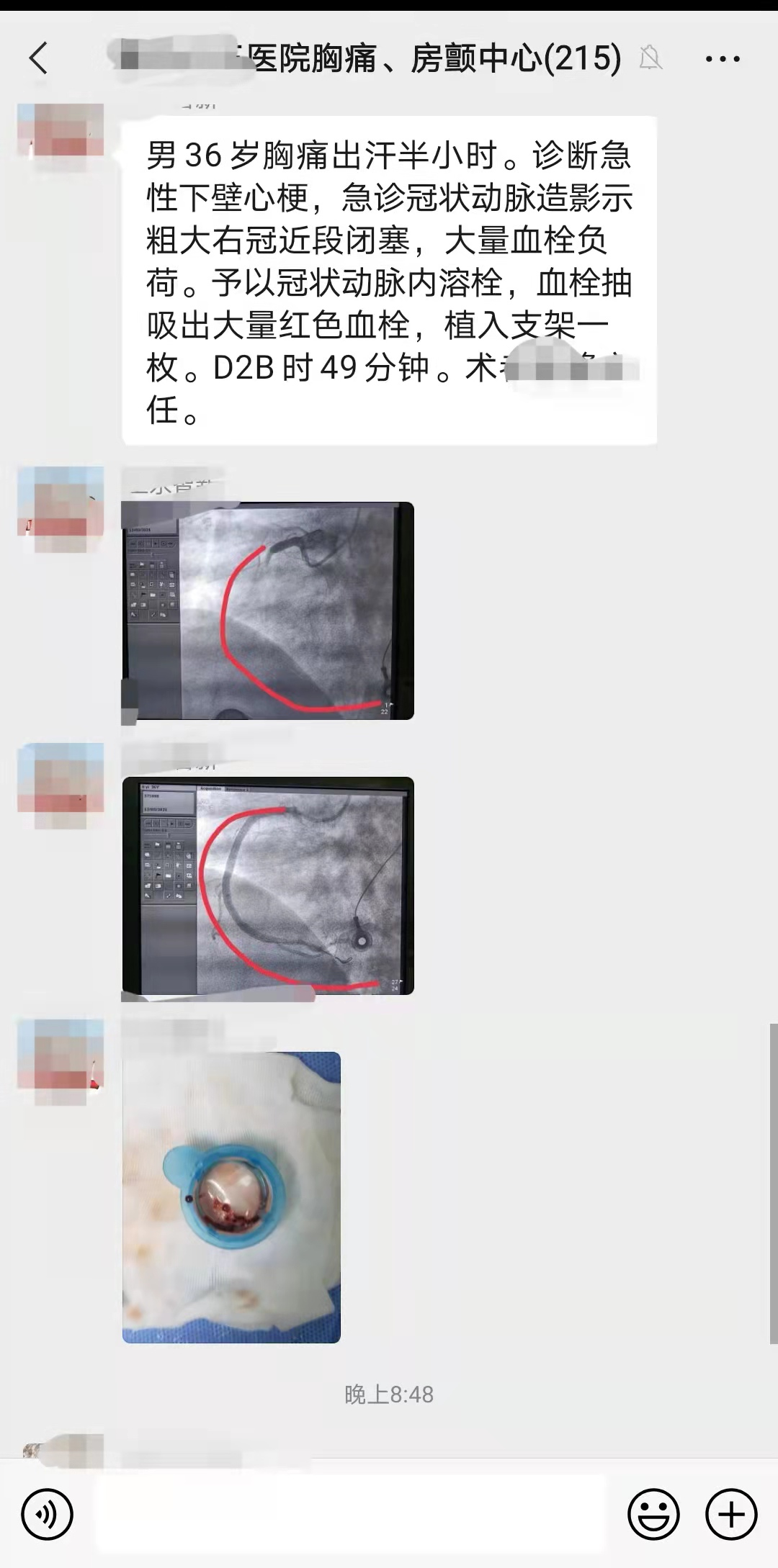 36岁男子胸痛不愿就诊，多亏母亲经常科普，拨打120救儿子一命