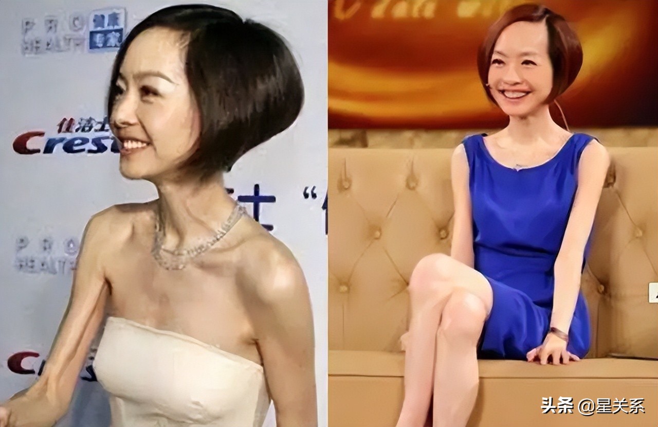 瘦到病态、黑绿嘴唇，这些畸形的审美让人看了浑身难受