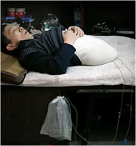 “半截人”彭水林：身体因车祸只剩78厘米，“重生”后回报社会